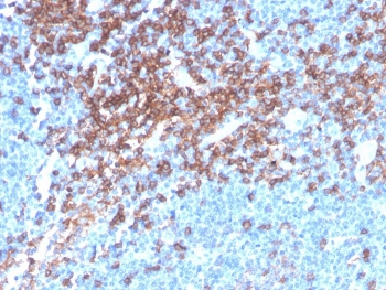 CD4 Antibody