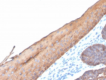 Type I Cytokeratin Antibody (CK10/14/15/16/19)