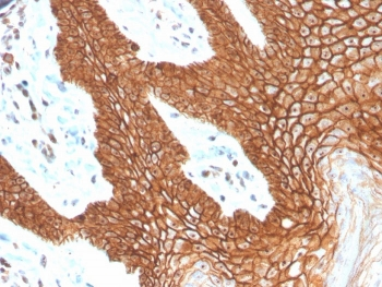 E-Cadherin Antibody / CDH1