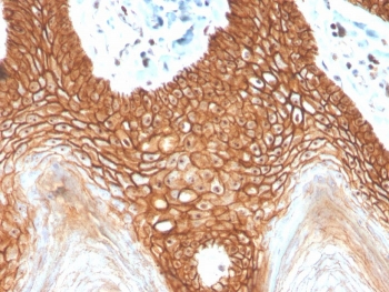 E-Cadherin Antibody / CDH1