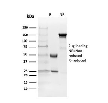 MBP Antibody / Myelin Basic Protein
