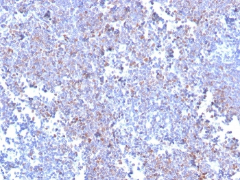 SOX11 Antibody