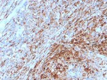 TIM-3 Antibody / HAVCR2