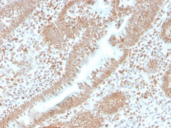 PMS2 Antibody / PMS1 homolog 2