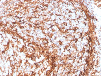 Vimentin Antibody
