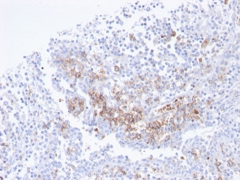 CD38 Antibody