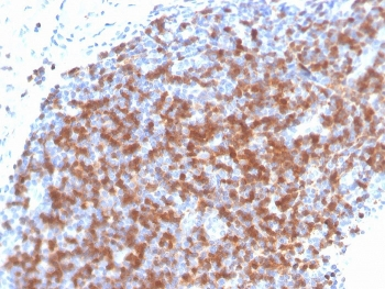 ZAP70 Antibody