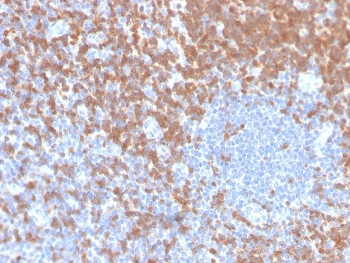 ZAP70 Antibody