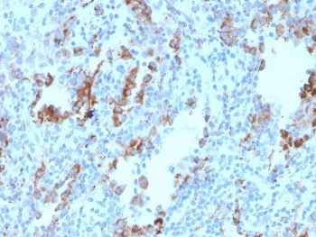 TIM-3 Antibody / HAVCR2