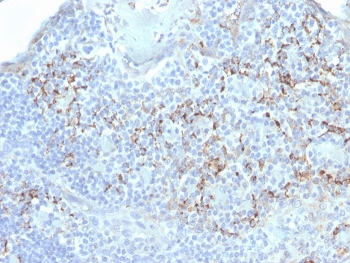 TIM3 Antibody / HAVCR2