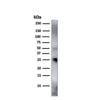 TIM3 Antibody / HAVCR2