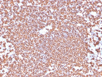 CD20 Antibody / MS4A1