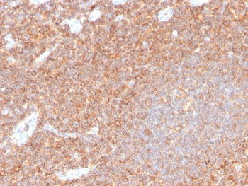 CD44 Antibody / HCAM
