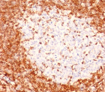 Bcl-2 Antibody