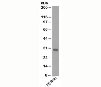 Bcl-2 Antibody Cocktail