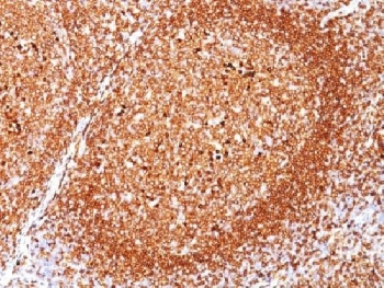CD79a Antibody