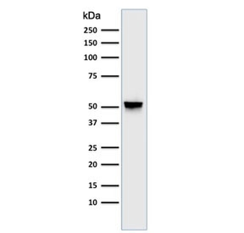 GFAP Antibody / Glial Fibrillary Acidic Protein