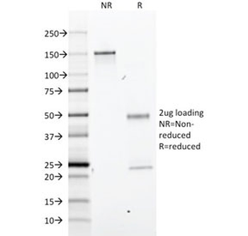 GFAP Antibody / Glial Fibrillary Acidic Protein