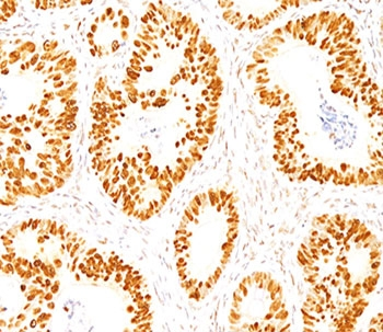 p53 Antibody (N-Terminal Region)