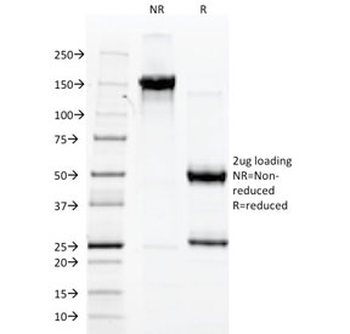 von Willebrand Factor Antibody / vWF