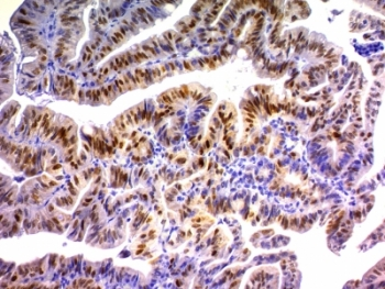p21 Antibody