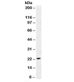 p21 Antibody