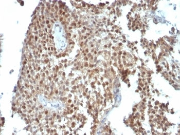 p21 Antibody