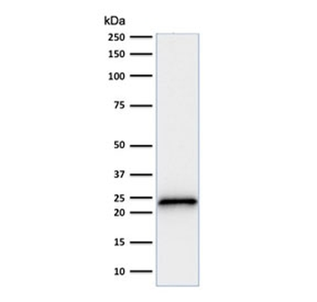 p21 Antibody