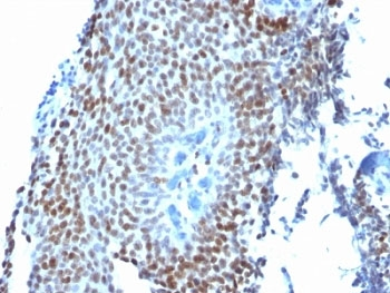 p21 Antibody