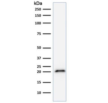 p21 Antibody