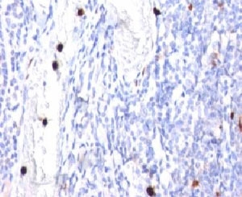 CSF3 Antibody / Granulocyte-Colony Stimulating Factor