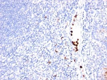 CSF3 Antibody / Granulocyte-Colony Stimulating Factor