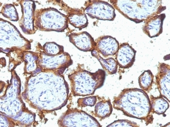 EGFR Antibody / Epidermal Growth Factor Receptor