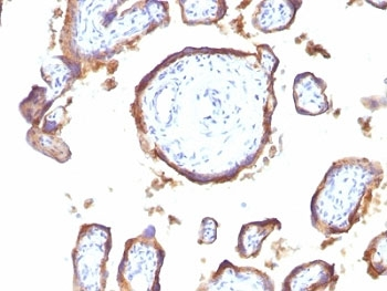 EGFR Antibody