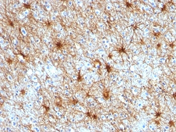 GFAP Antibody / Glial Fibrillary Acidic Protein