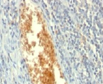 AMPD3 Antibody