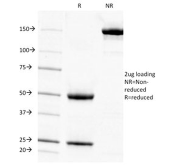 AMPD3 Antibody