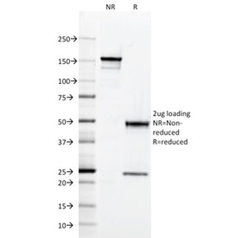 HLA-DQ Antibody (MHC II)