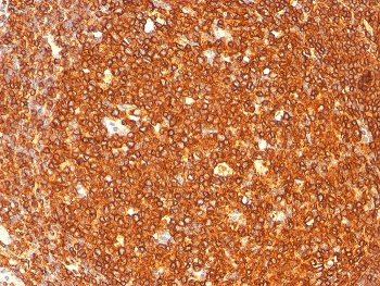 HLA-DRB1 Antibody (MHC II)
