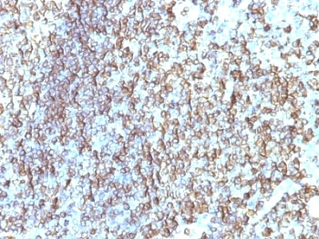 HLA-DRB1 Antibody (MHC II)