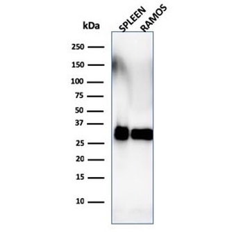 HLA-DRB1 Antibody (MHC II)