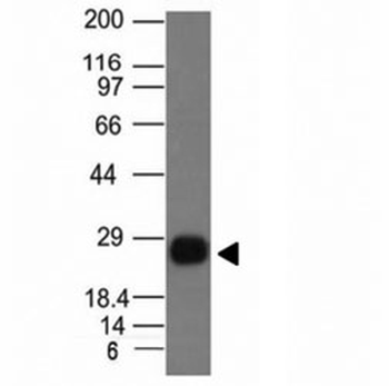HLA-DRB1 Antibody (MHC II)