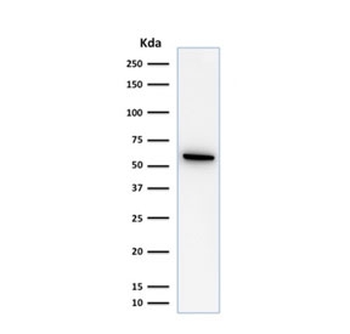 HSP60 Antibody / HSPD1
