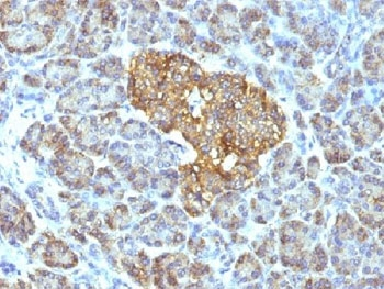 HSP60 Antibody / HSPD1