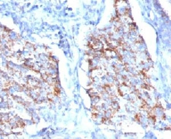 HSP60 Antibody