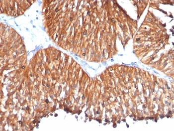 HSP60 Antibody