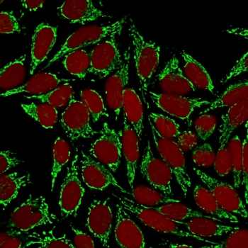 HSP60 Antibody