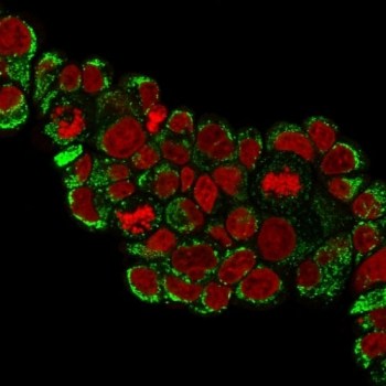 HSP60 Antibody