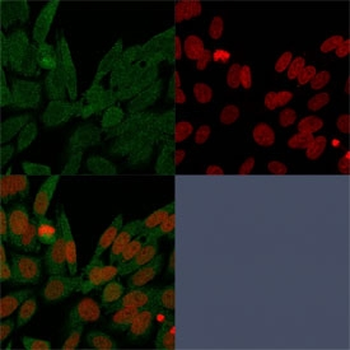 IDH1 Antibody