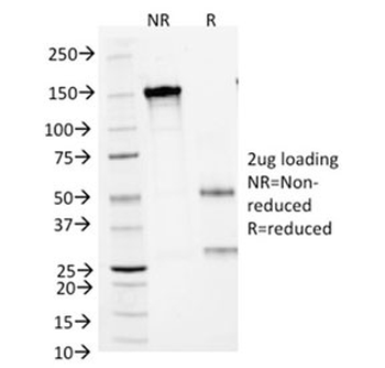 Arginase 1 Antibody